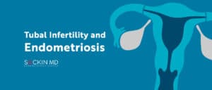 Tubal Infertility and Endometriosis