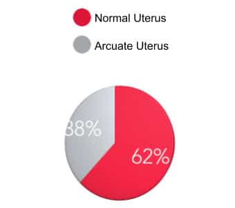 arcuate uterus was found to be in 38%