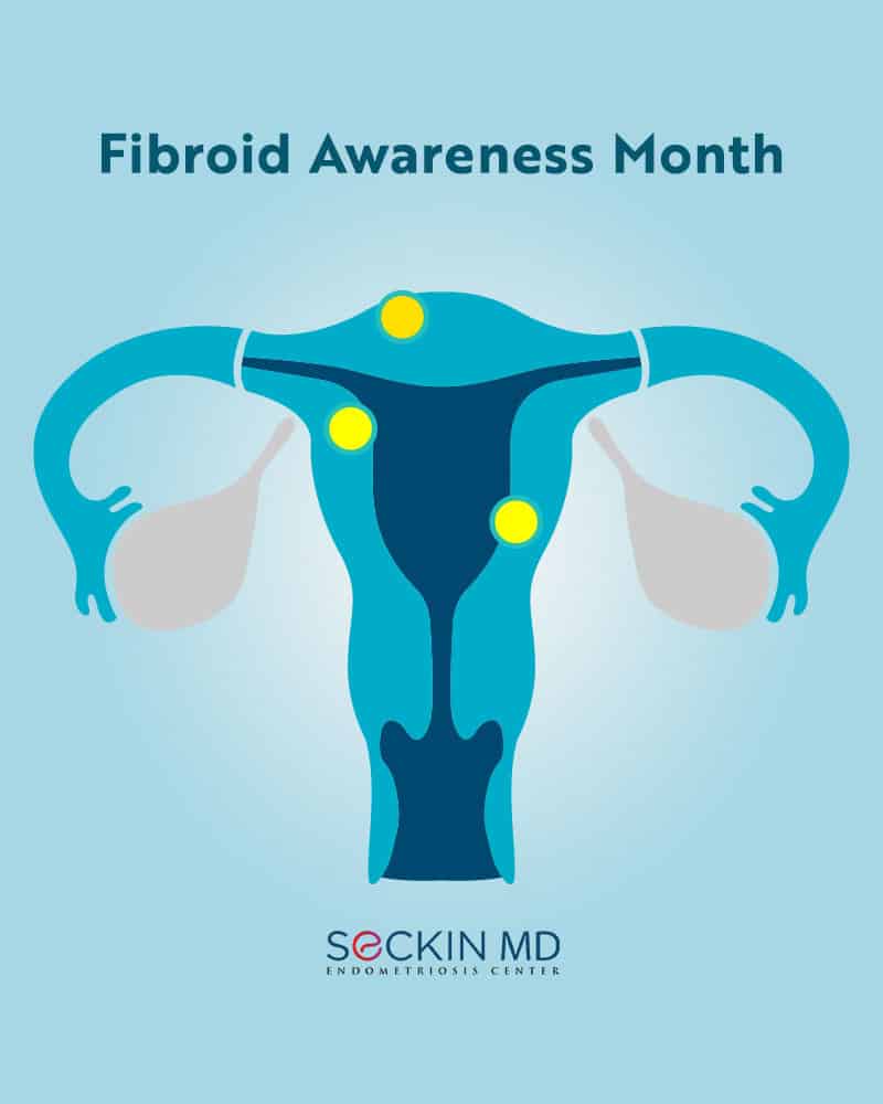 July Is Fibroid Awareness Month