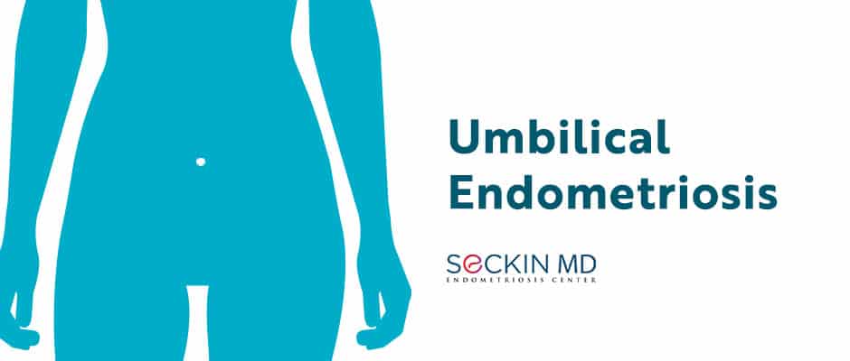 Umbilical Endometriosis