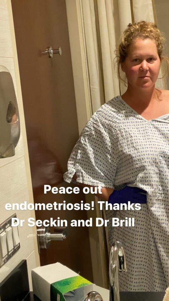Amy Schumer Endometriosis Surgery, Hysterectomy, Appendectomy