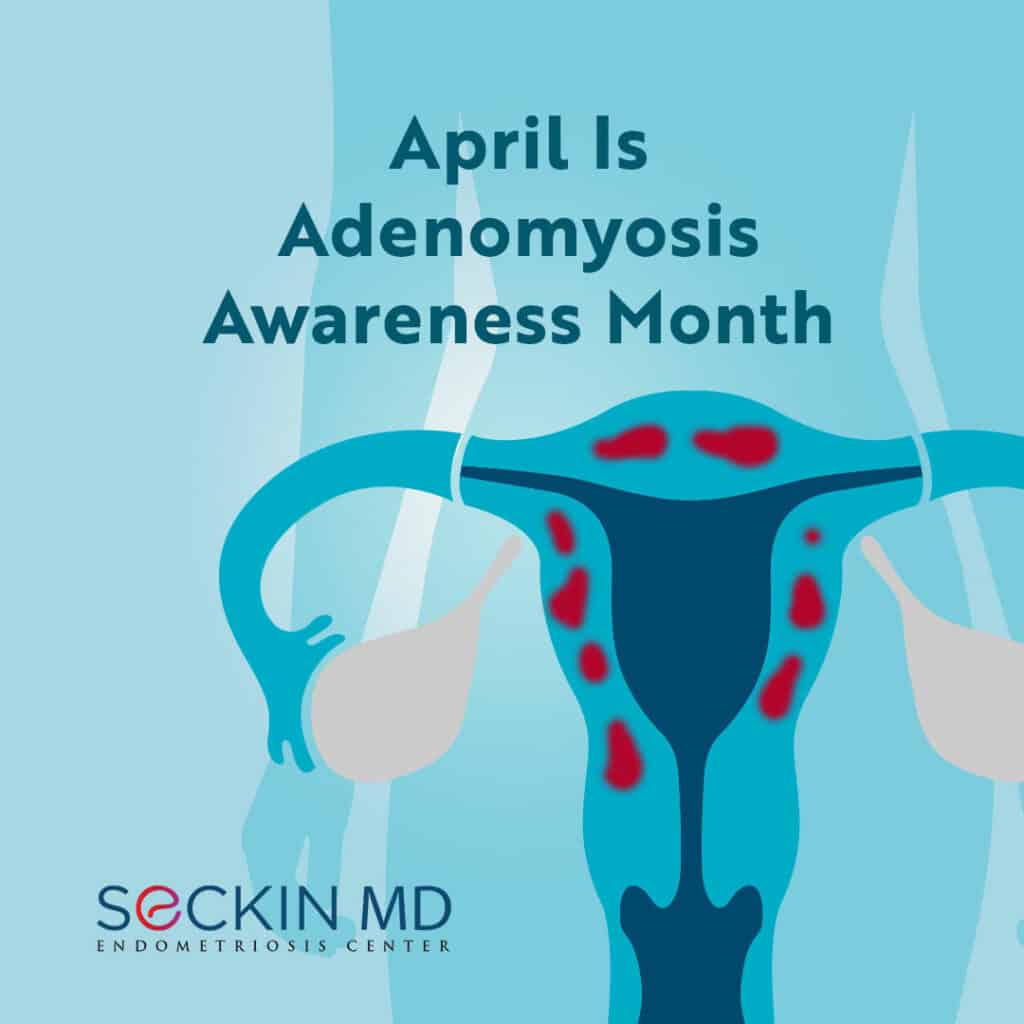 April Is  Adenomyosis  Awareness Month