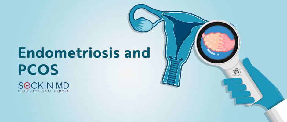 Endometriosis and PCOS