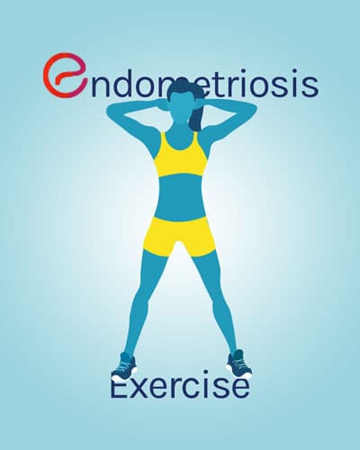 Can exercise prevent endometriosis?