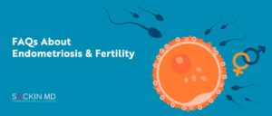 FAQs About Endometriosis & Fertility