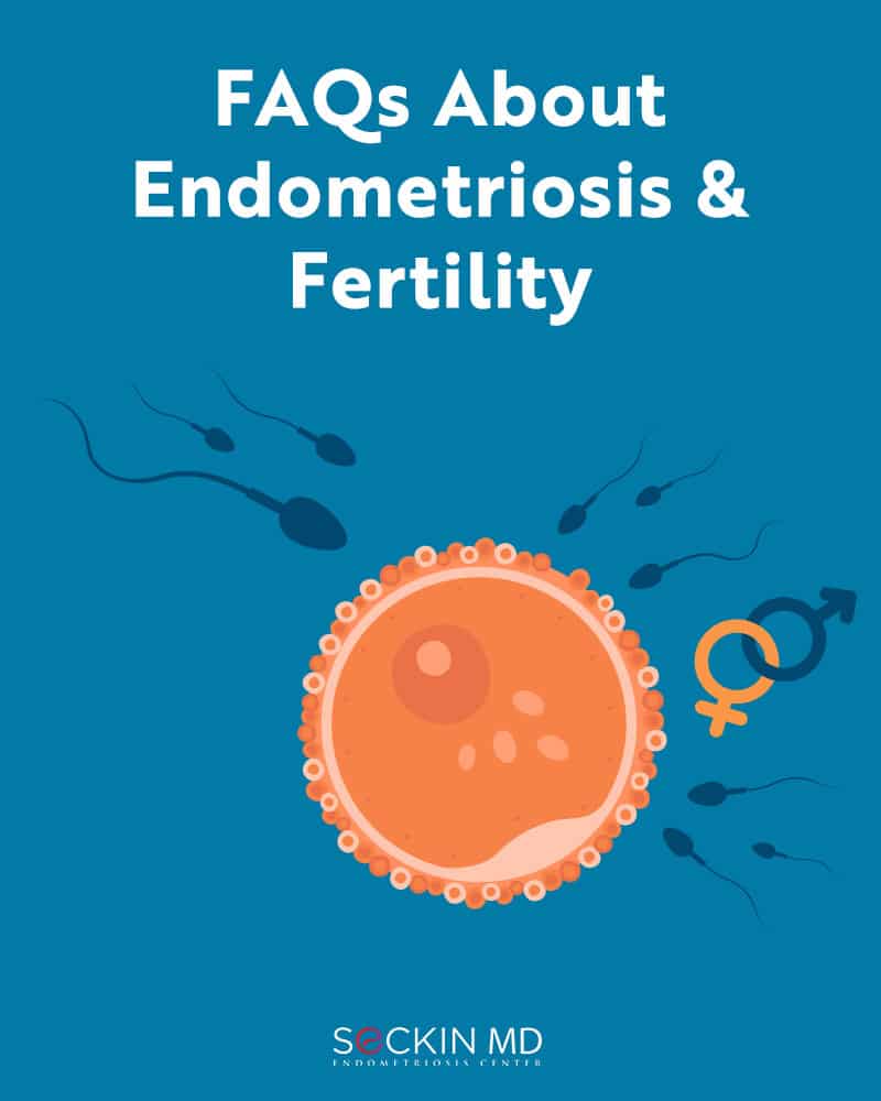 FAQs About Endometriosis & Fertility