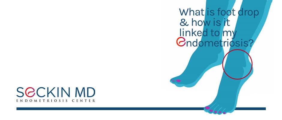 What Is Foot Drop and How Is it Linked to Endometriosis?