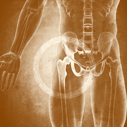 Hip Joint / Femur - Anatomy Bones