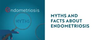 Myths and Facts About Endometriosis