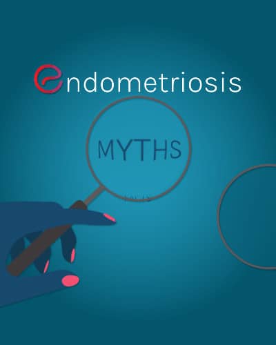 Myths and Facts About
Endometriosis