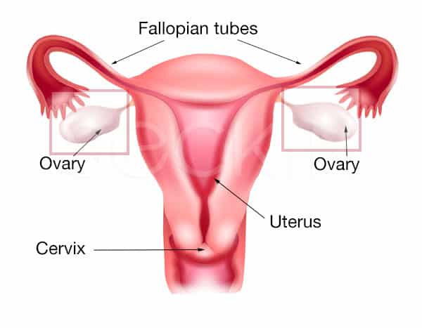 ovarian cycts uterus