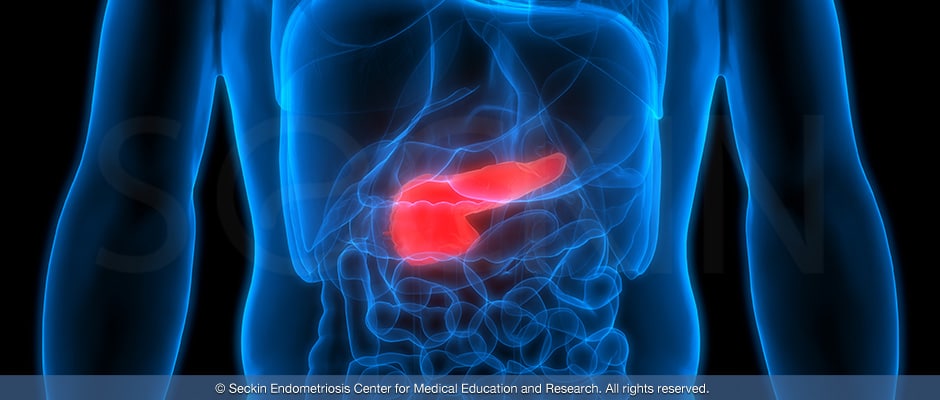 The pancreas sits in the abdomen and is surrounded by the stomach, small intestine, liver, spleen, and gallbladder.