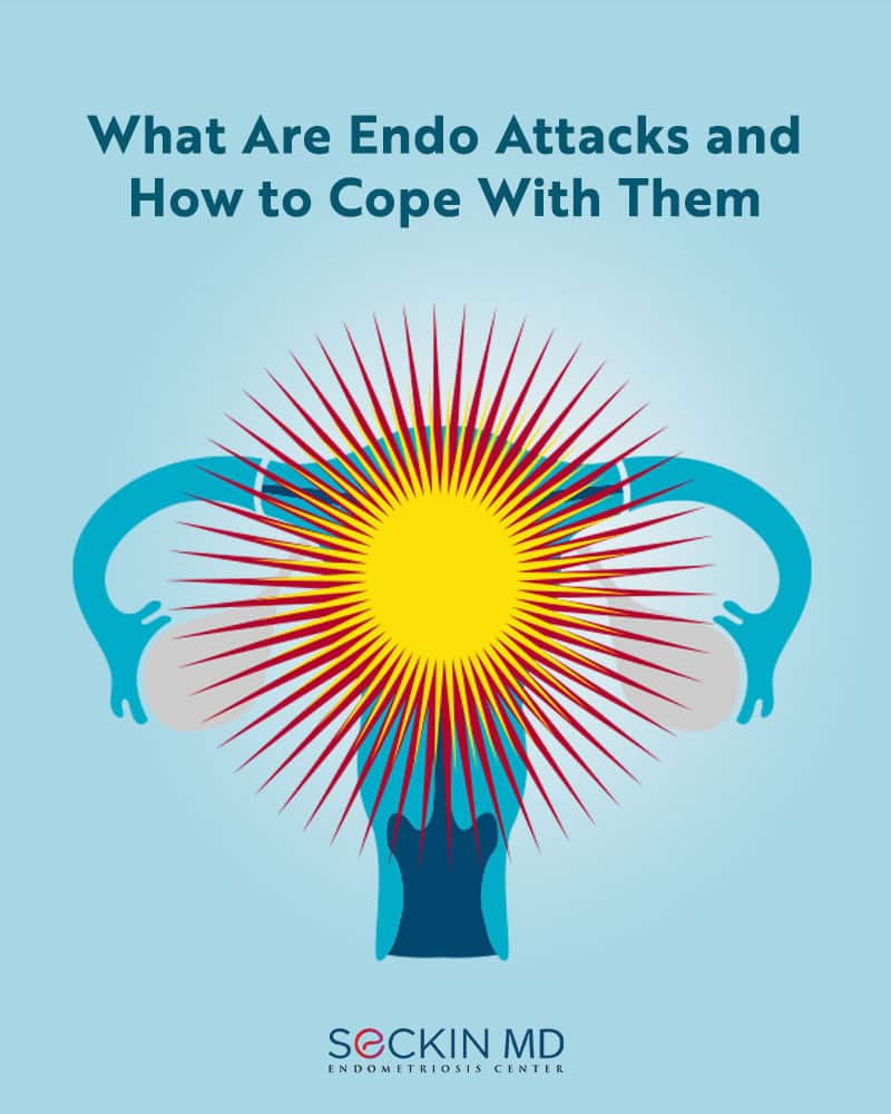 What Are Endo Attacks and How to Cope With Them