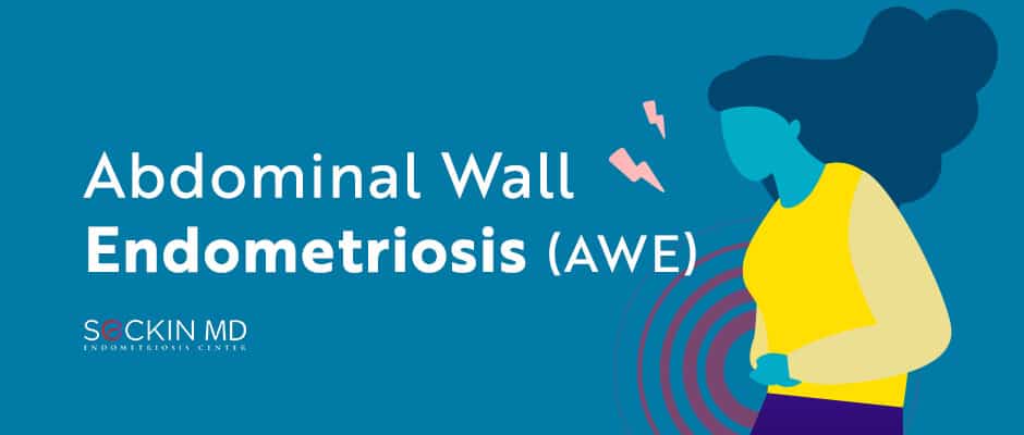 Abdominal Wall Endometriosis (AWE)