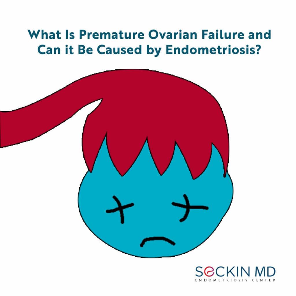 What Is Premature Ovarian Failure and Can it Be Caused by Endometriosis?