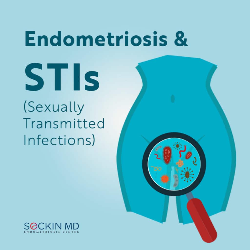 Endometriosis and STIs