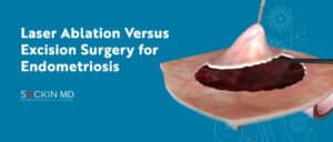 Laser Ablation Versus Excision Surgery for Endometriosis