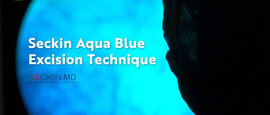 Seckin Aqua Blue Excision Technique