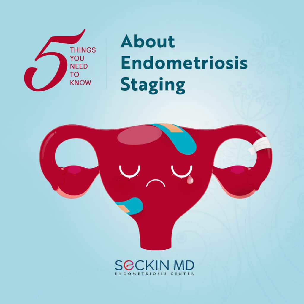 5 Things You Need to Know About Endometriosis Staging