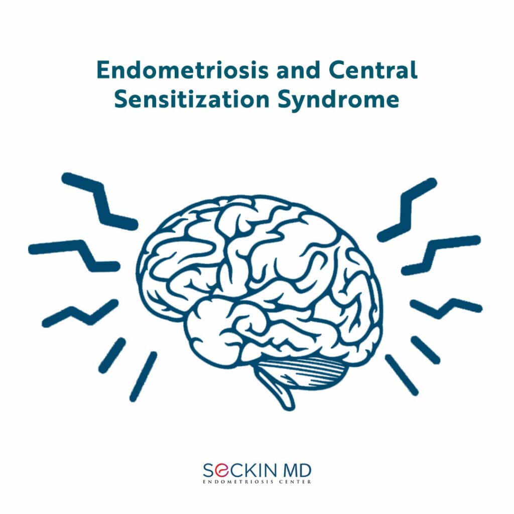 Endometriosis and Central Sensitization Syndrome