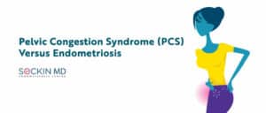 Pelvic Congestion Syndrome (PCS) Versus Endometriosis