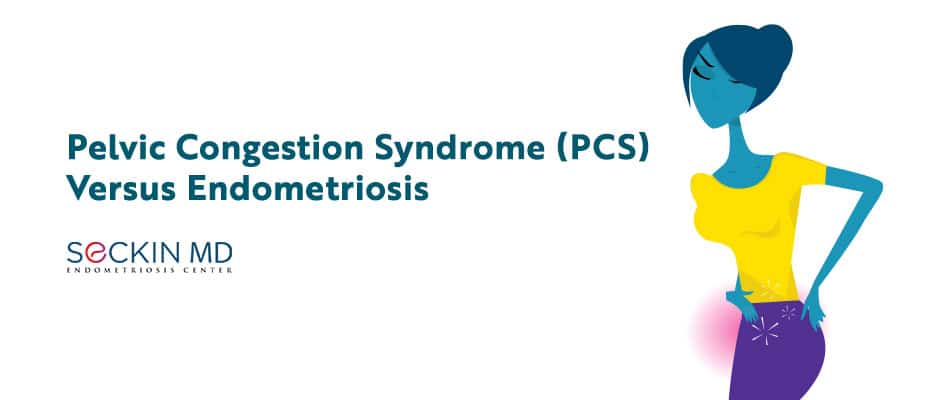 Pelvic Congestion Syndrome (PCS) Versus Endometriosis