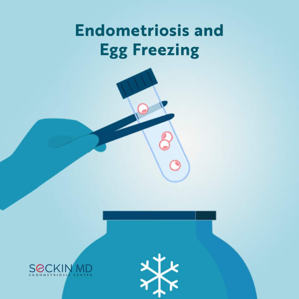 Endometriosis and Egg Freezing