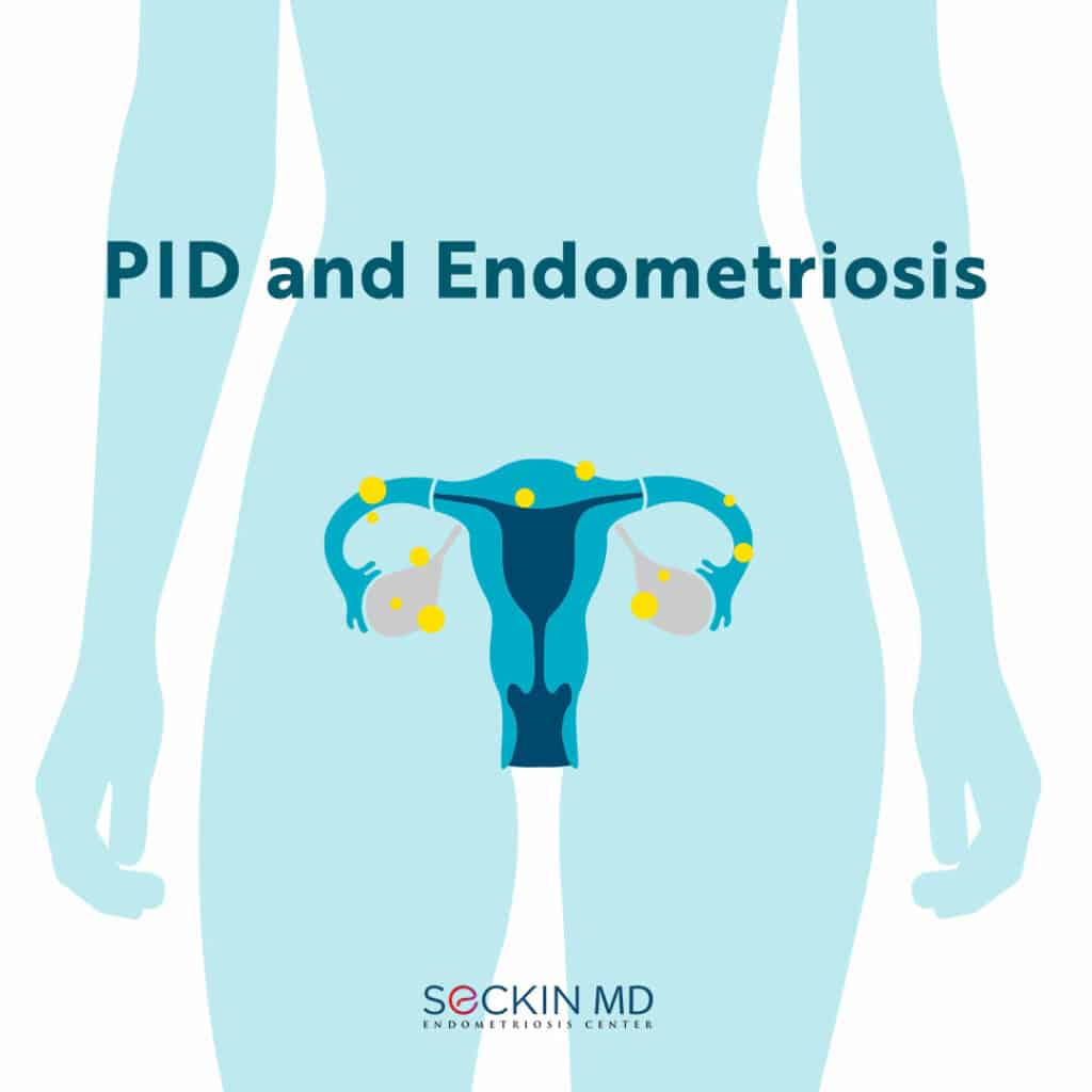 ID and Endometriosis