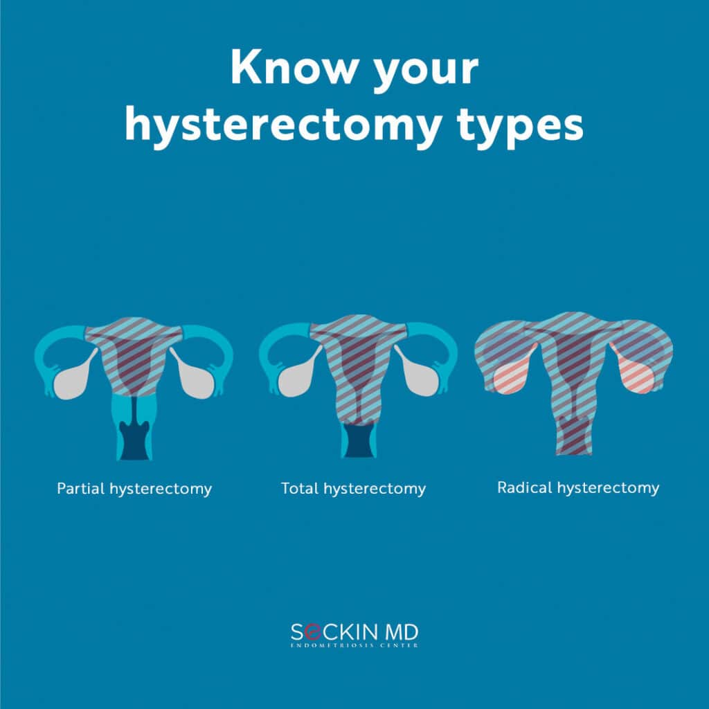 Know your hysterectomy types