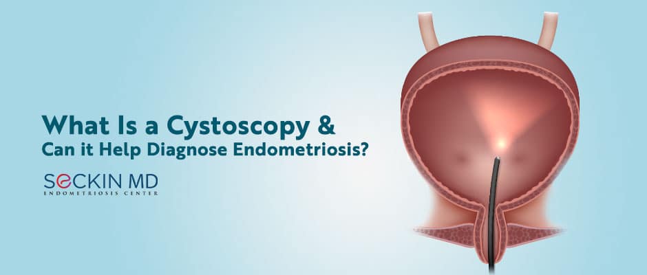 What Is a Cystoscopy and Can it Help Diagnose Endometriosis?