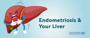 Endometriosis and Your Liver