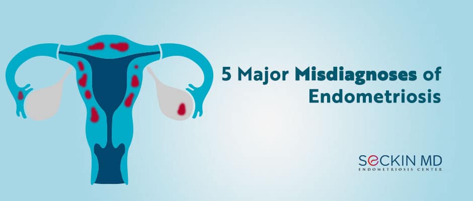 5 Major Misdiagnoses of Endometriosis