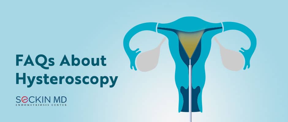 FAQs About Hysteroscopy