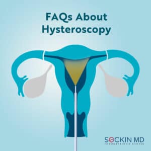 FAQs About Hysteroscopy