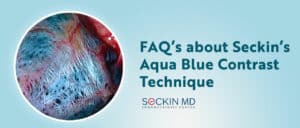 FAQ’s about Seckin’s Aqua Blue Contrast Technique