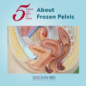 5 Things You Need to Know About Frozen Pelvis